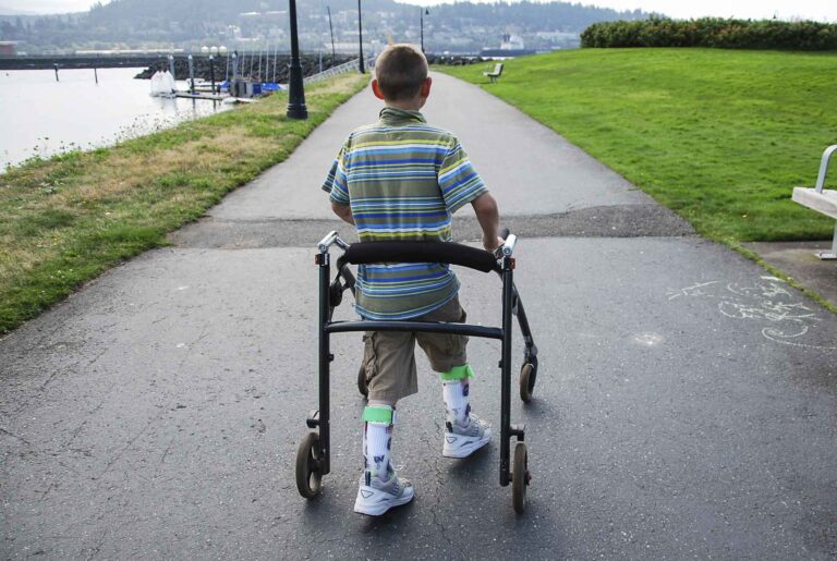 Pediatric Prosthetics Cleveland TN